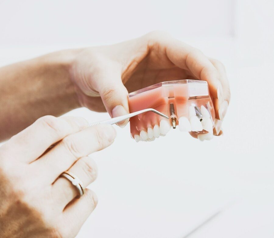 person wearing silver-colored ring while holding denture